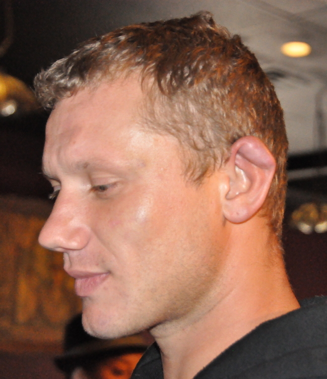 Cauliflower ear