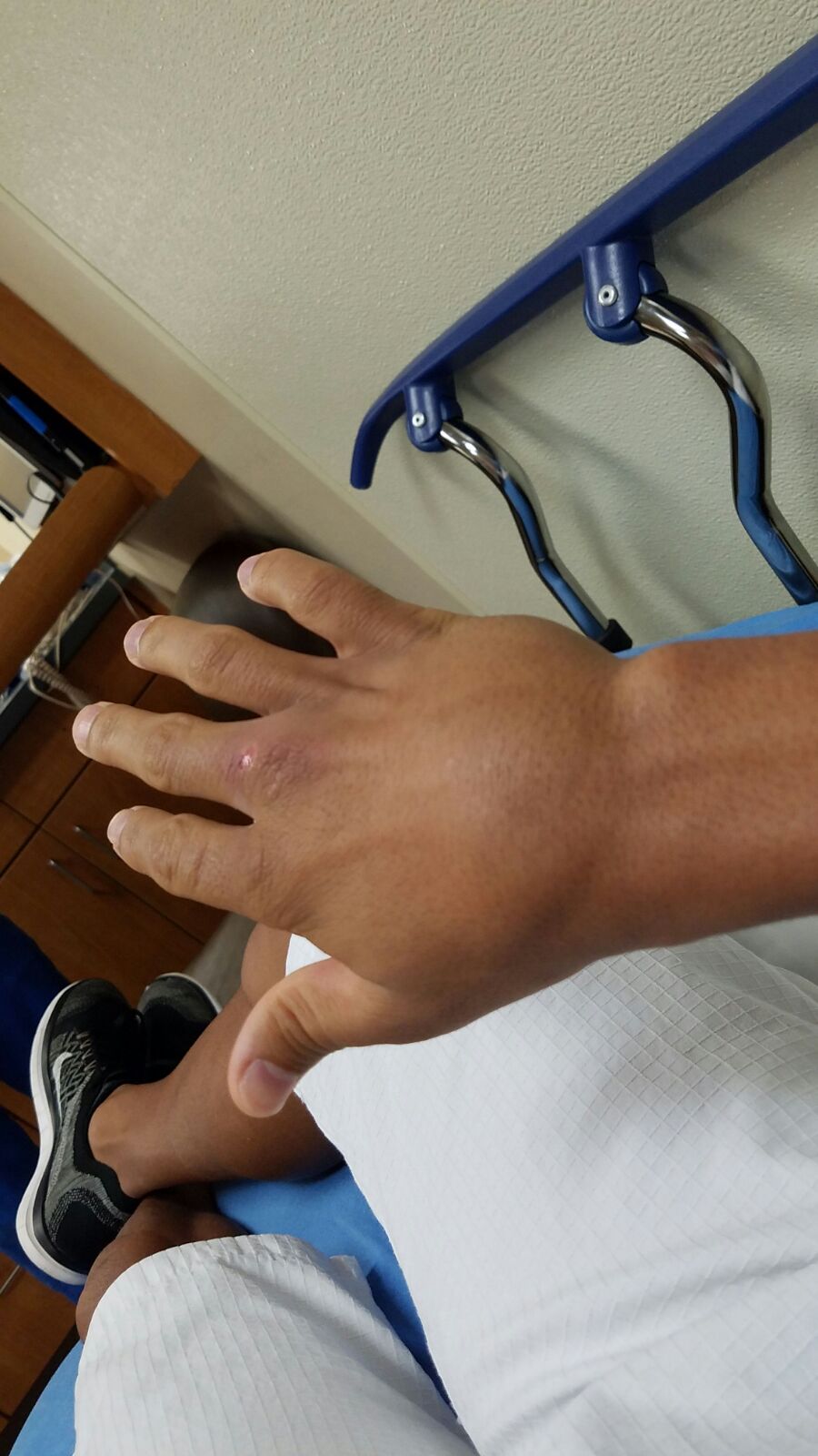 Sports injury